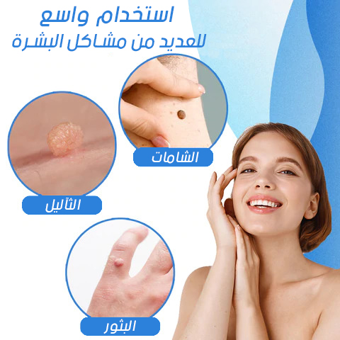 قلم ازالة الثآليل والزوائد الجلدية الأكثر مبيعا في المملكة