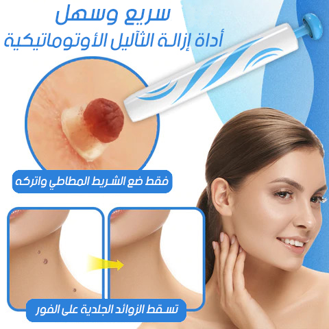 قلم ازالة الثآليل والزوائد الجلدية الأكثر مبيعا في المملكة