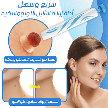 قلم ازالة الثآليل والزوائد الجلدية الأكثر مبيعا في المملكة