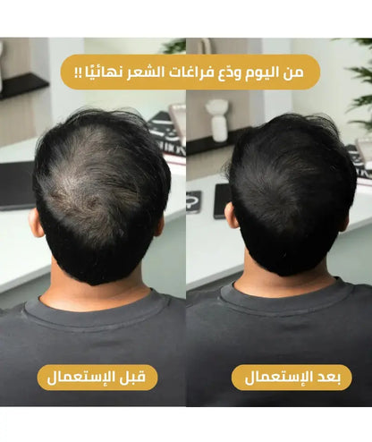 قنية الميكرو-كثافة لشعر ممتلئ طبيعي و مقاوم 100% للماء ، الحرارة و العرق 3  قطع