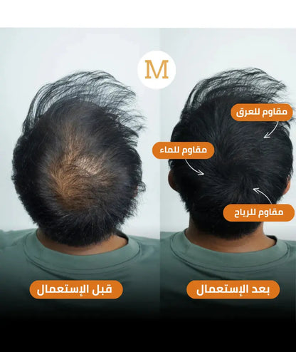قنية الميكرو-كثافة لشعر ممتلئ طبيعي و مقاوم 100% للماء ، الحرارة و العرق 3  قطع