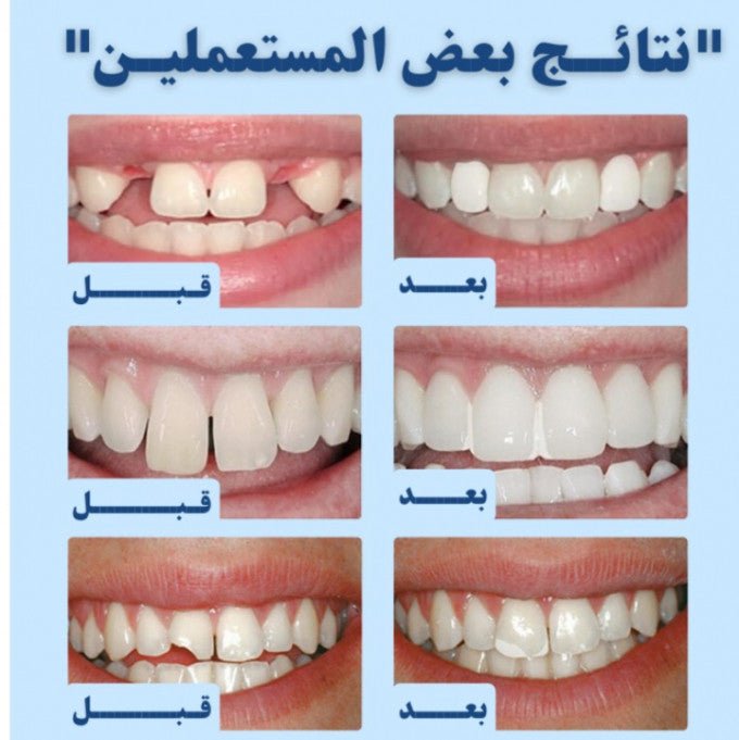 حبيبات إصلاح الأسنان الاكثر مبيعا في الامارات UAE (عدد 2) - Makfool
