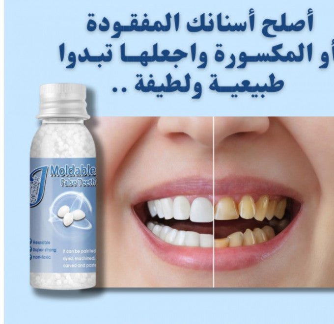 حبيبات إصلاح الأسنان الاكثر طلباً و مبيعا في السعودية - Makfool