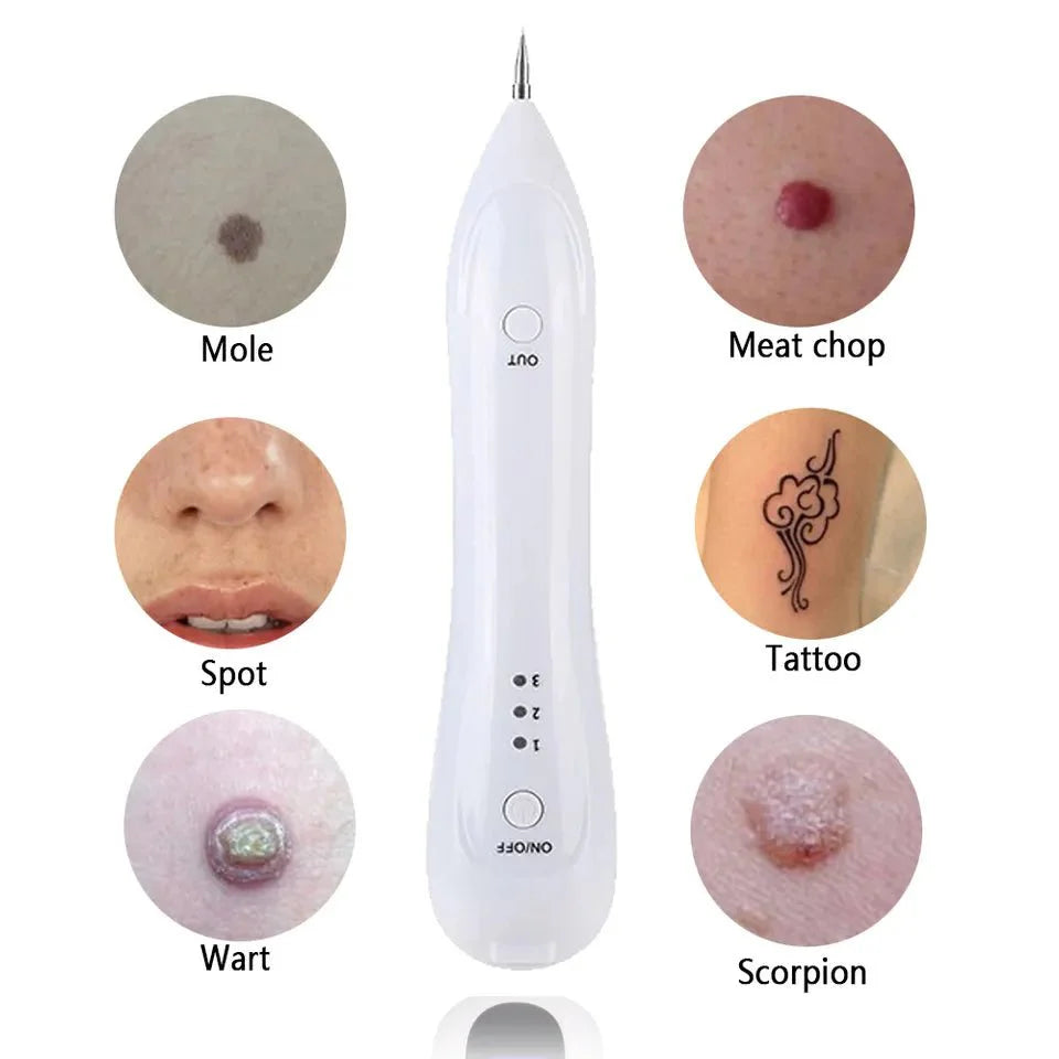Oveallgo™ PRO Spotfree قلم ازالة الشامات والزوائد الجلدية - Makfool