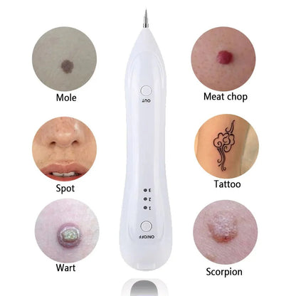 Oveallgo™ PRO Spotfree قلم ازالة الشامات والزوائد الجلدية - Makfool