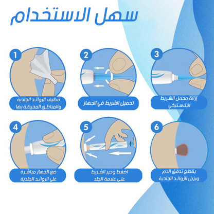 قلم ازالة الثآليل والزوائد الجلدية الأكثر مبيعا في المملكة